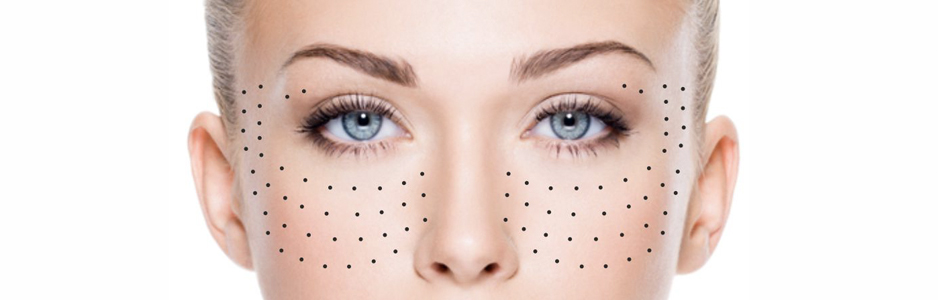 Биоревитализация